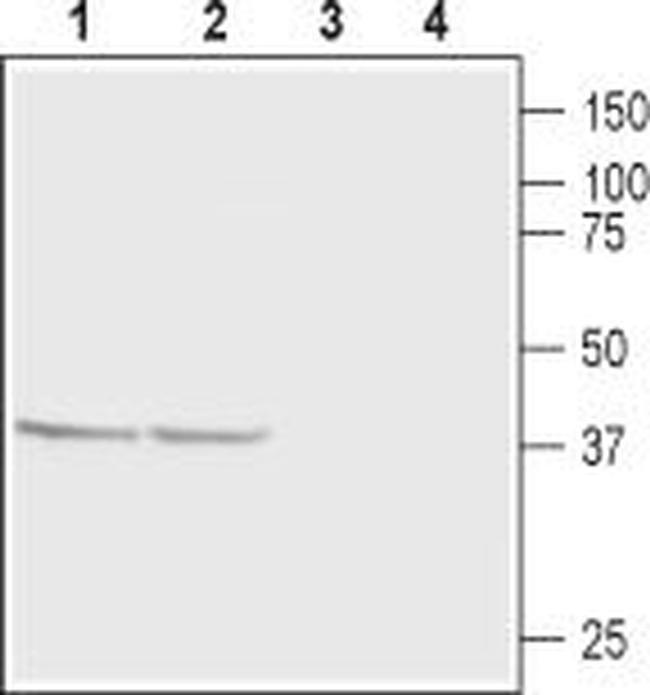 CaBP1 Antibody in Western Blot (WB)