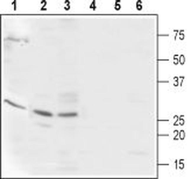 CaBP2 Antibody in Western Blot (WB)