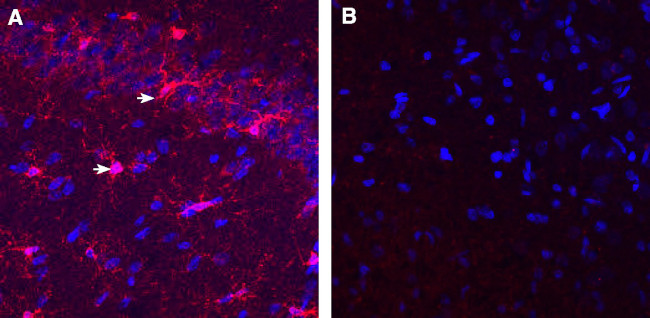 IBA1/AIF1 Antibody in Immunohistochemistry (Frozen) (IHC (F))