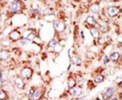 ACSL3 Antibody in Immunohistochemistry (IHC)