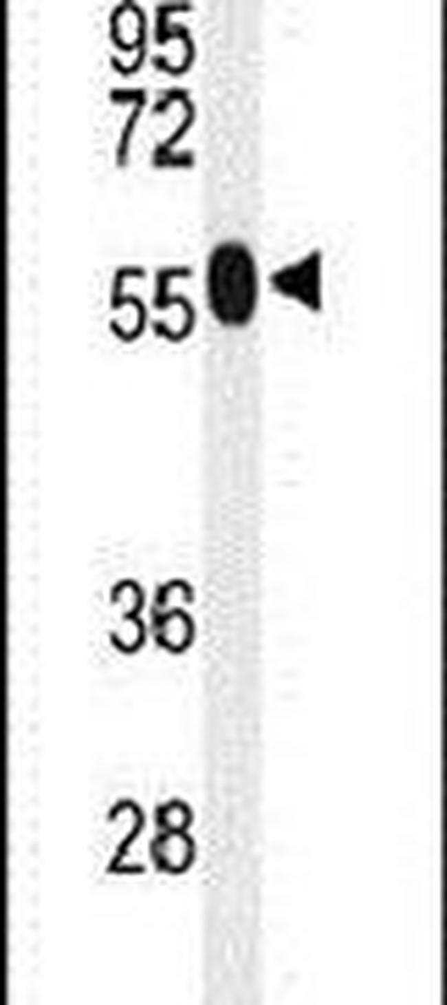 ACSM1 Antibody in Western Blot (WB)