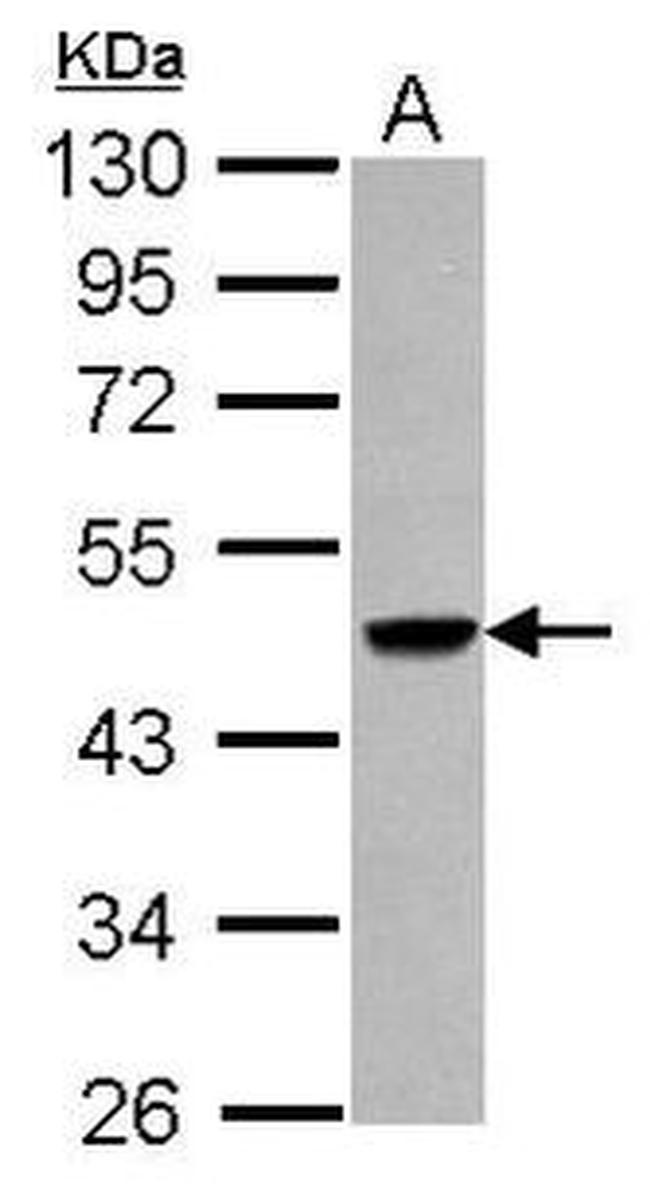 ACSM3 Antibody in Western Blot (WB)