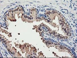 ACSS2 Antibody in Immunohistochemistry (Paraffin) (IHC (P))