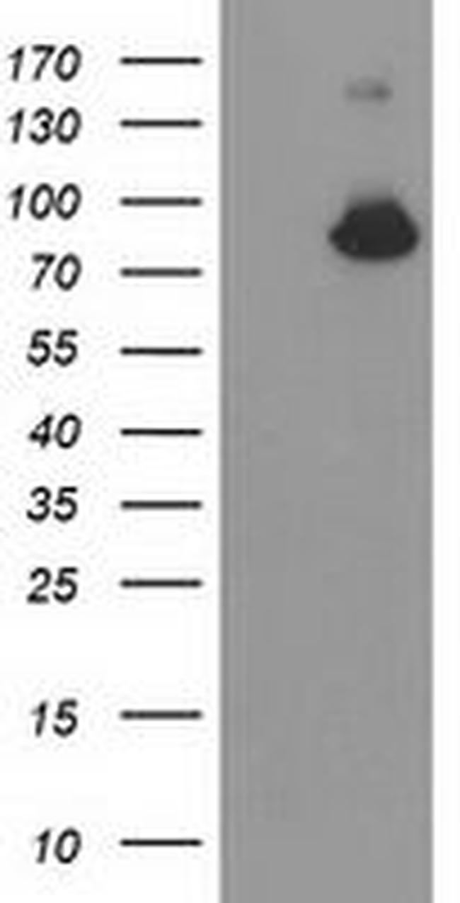 ACSS2 Antibody in Western Blot (WB)