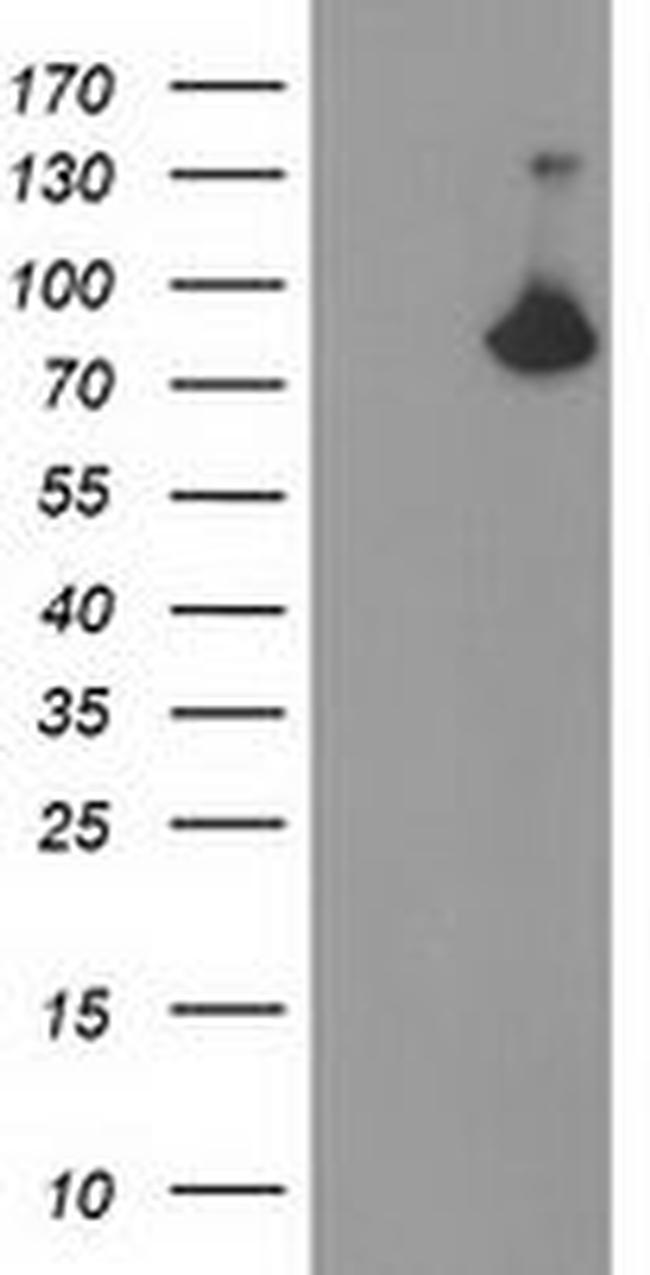 ACSS2 Antibody in Western Blot (WB)
