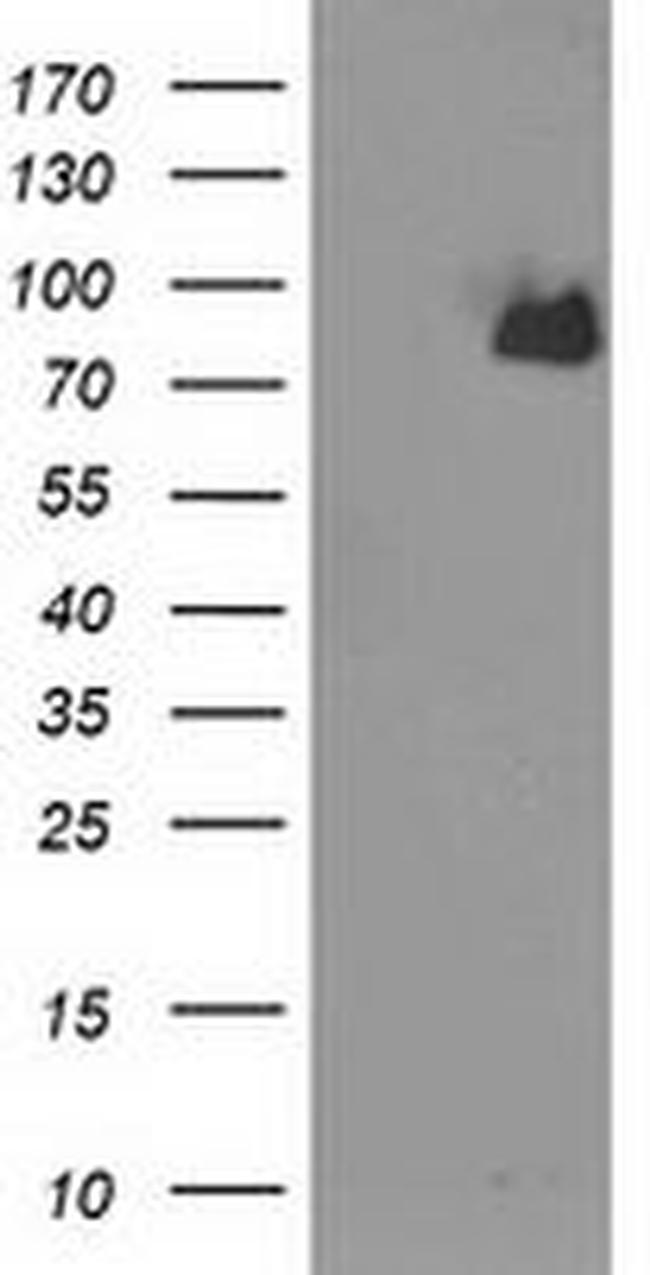 ACSS2 Antibody in Western Blot (WB)