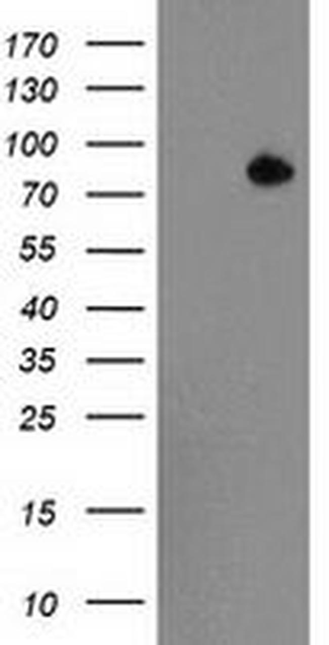 ACSS2 Antibody in Western Blot (WB)