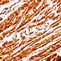 ACTA2 (smooth muscle actin alpha, SMA) Antibody in Immunohistochemistry (IHC)