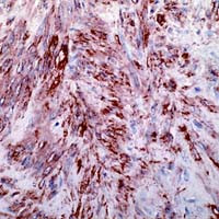 Alpha-Smooth Muscle Actin Antibody in Immunohistochemistry (IHC)