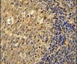 Actin Antibody in Immunohistochemistry (IHC)