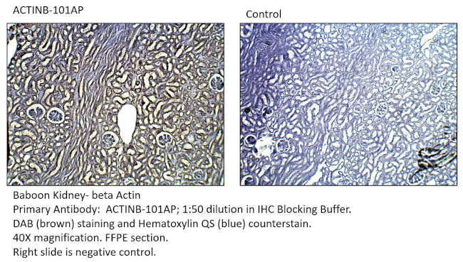 beta Actin Antibody in Immunohistochemistry (IHC)