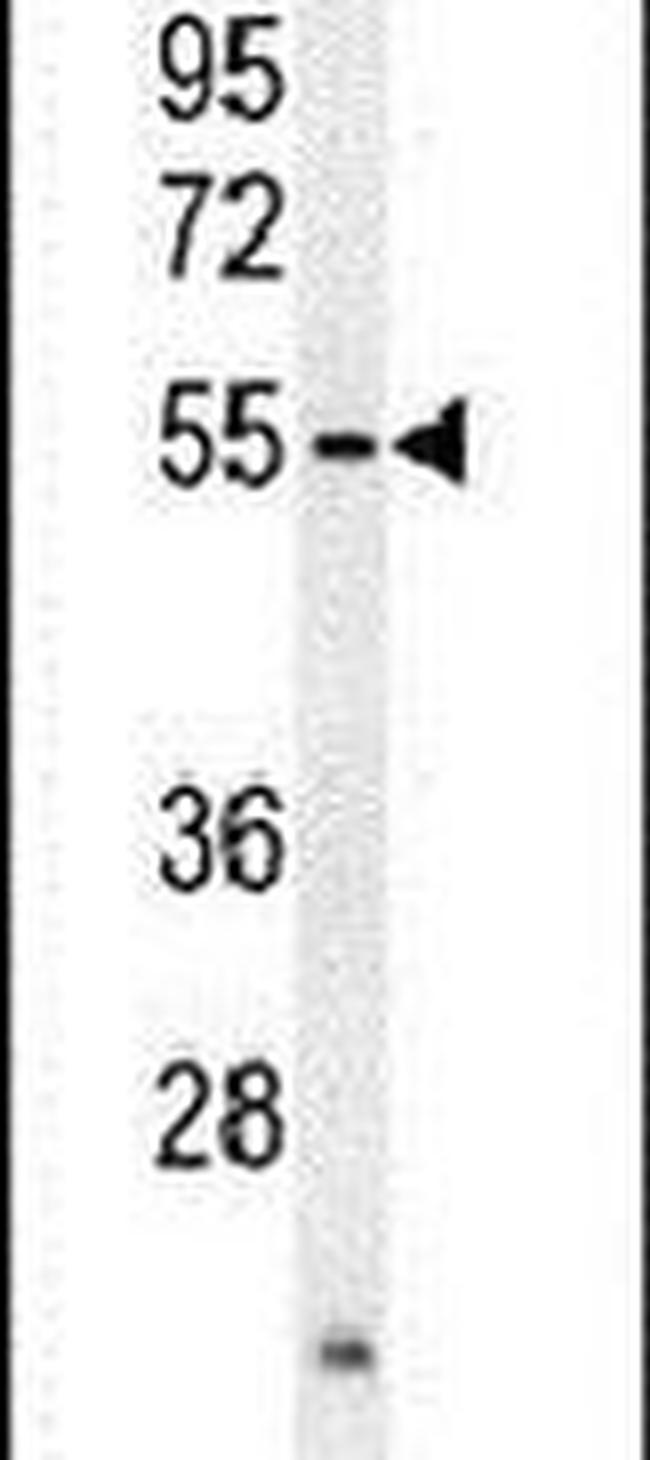 Actin-like 7A Antibody in Western Blot (WB)