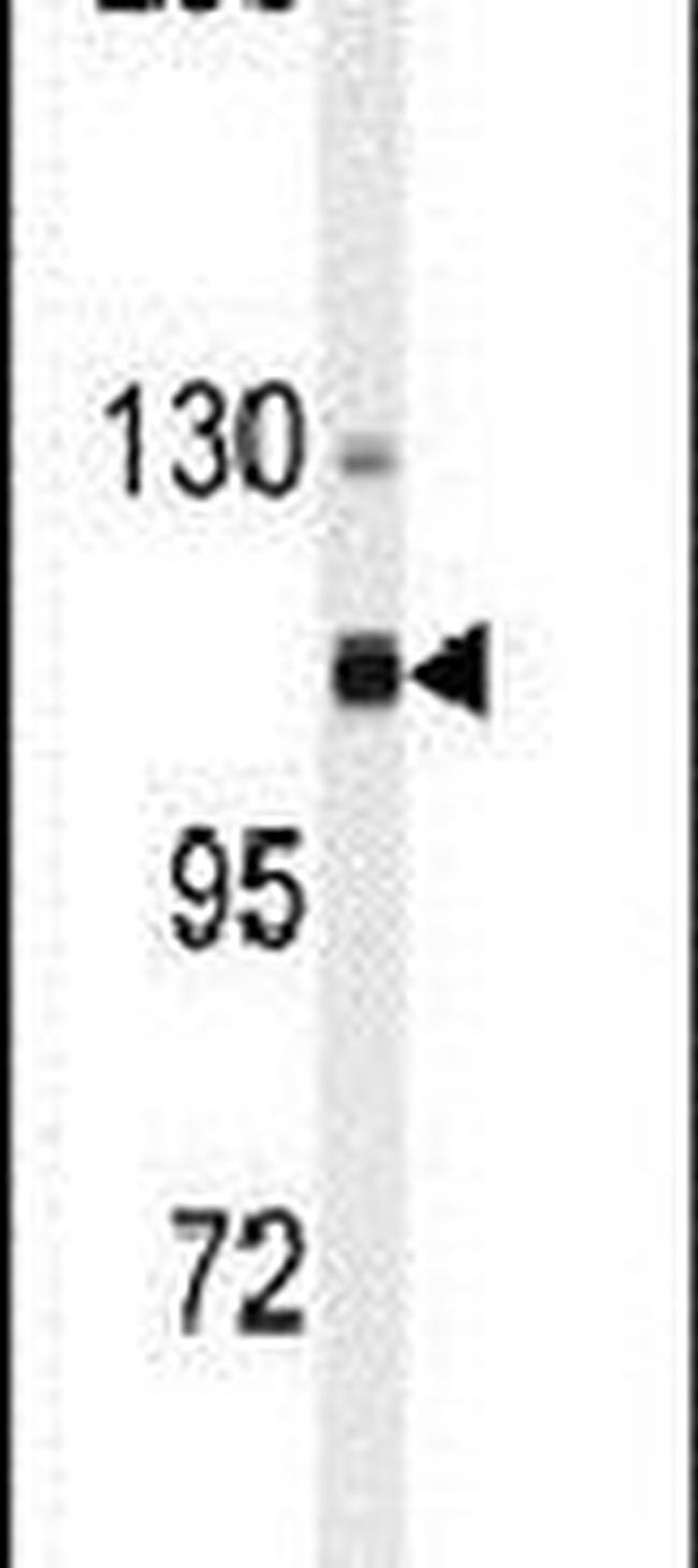 alpha Actinin 4 Antibody in Western Blot (WB)
