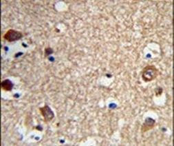 ACTR5 Antibody in Immunohistochemistry (IHC)
