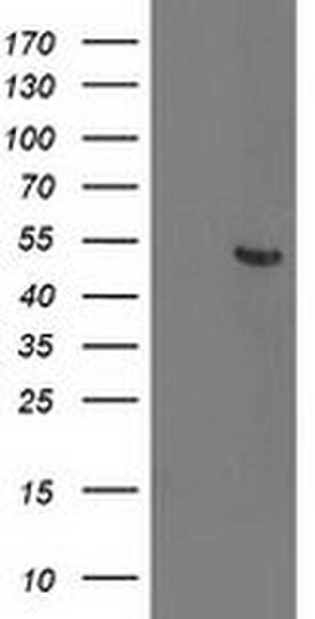 ACY1 Antibody in Western Blot (WB)