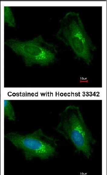 ADAM12 Antibody in Immunocytochemistry (ICC/IF)