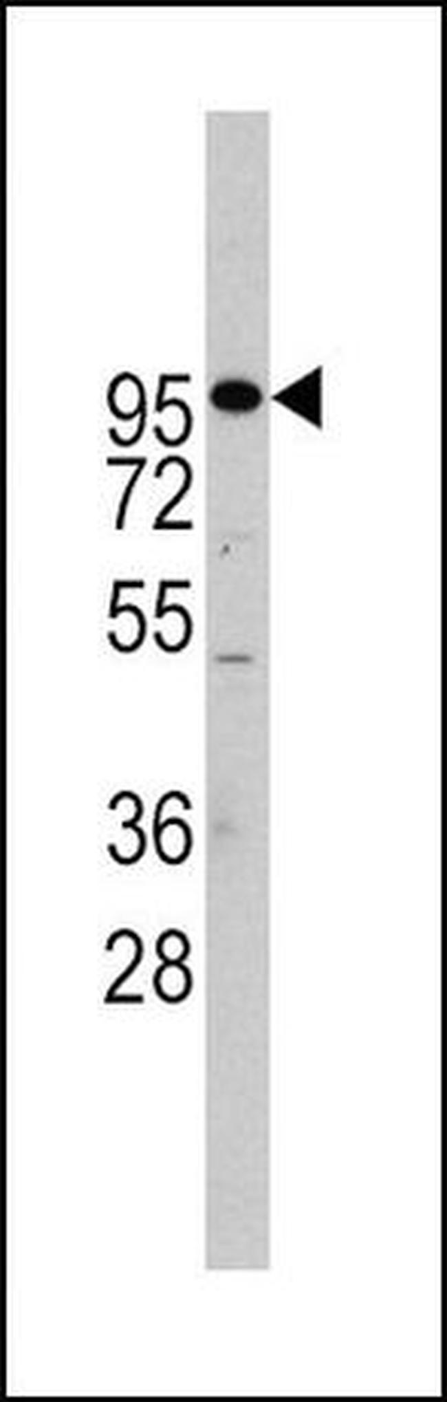 ADAM17 Antibody in Western Blot (WB)