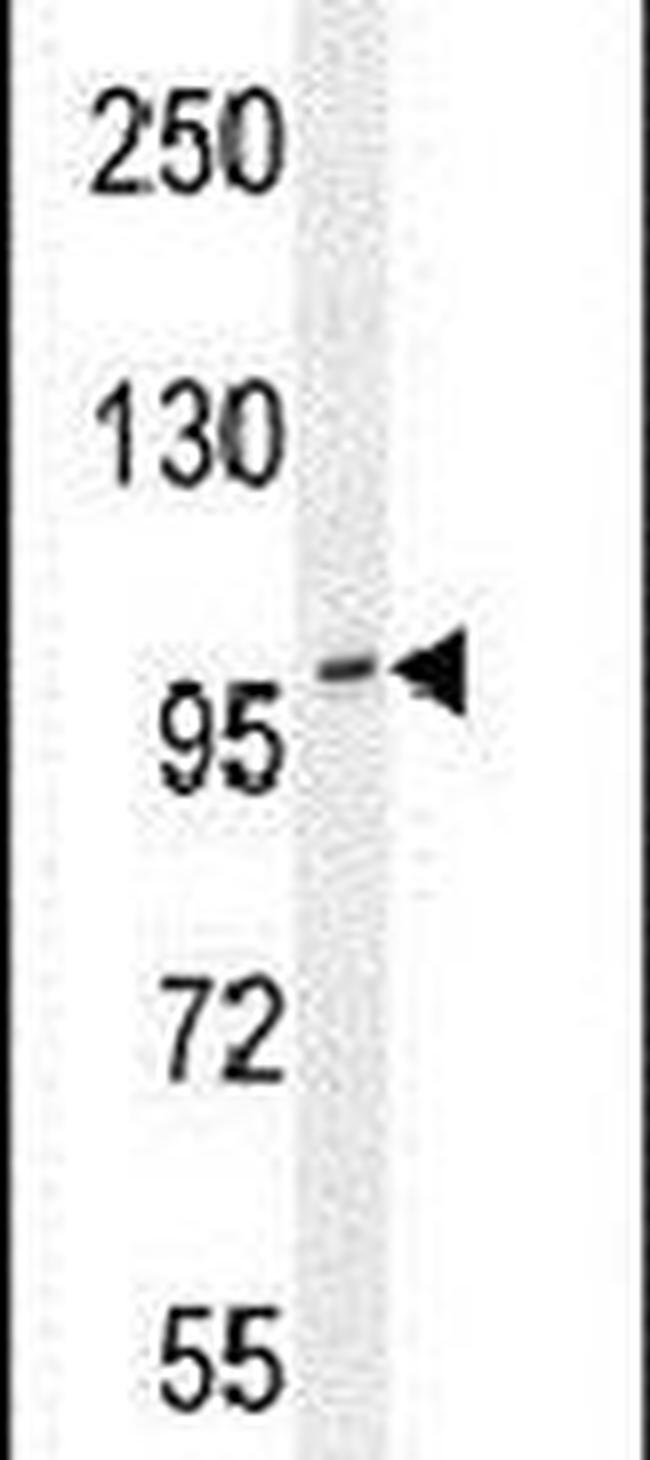 ADAMTS10 Antibody in Western Blot (WB)