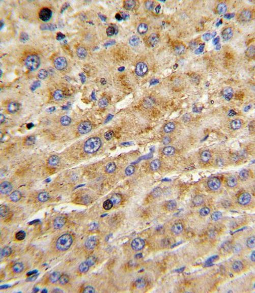ADAMTS13 Antibody in Immunohistochemistry (IHC)