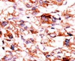 ADCK5 Antibody in Immunohistochemistry (IHC)