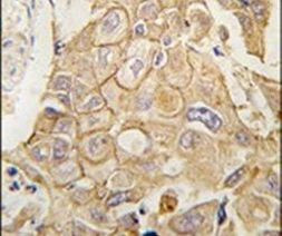 ADCY2 Antibody in Immunohistochemistry (IHC)