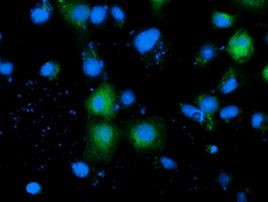 ADH1B Antibody in Immunocytochemistry (ICC/IF)