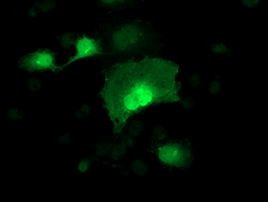 ADH1B Antibody in Immunocytochemistry (ICC/IF)