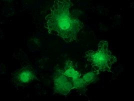 ADH1B Antibody in Immunocytochemistry (ICC/IF)