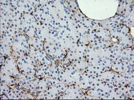 ADH1B Antibody in Immunohistochemistry (Paraffin) (IHC (P))