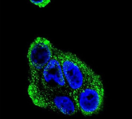 Alcohol Dehydrogenase 1B Antibody in Immunocytochemistry (ICC/IF)