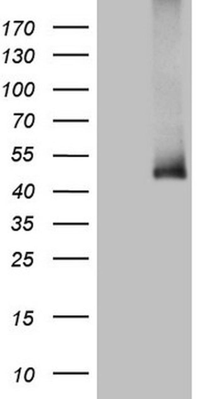ADH5 Antibody in Western Blot (WB)