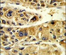 ADH6 Antibody in Immunohistochemistry (IHC)