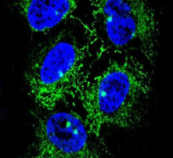 ADH7 Antibody in Immunocytochemistry (ICC/IF)