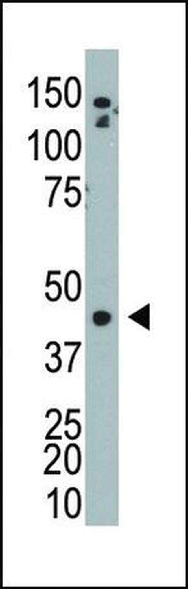Adenosine Kinase Antibody in Western Blot (WB)