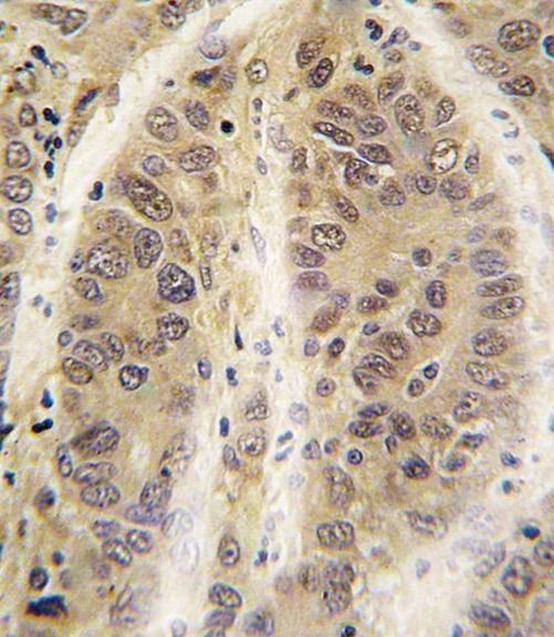 Adenosine Kinase Antibody in Immunohistochemistry (IHC)