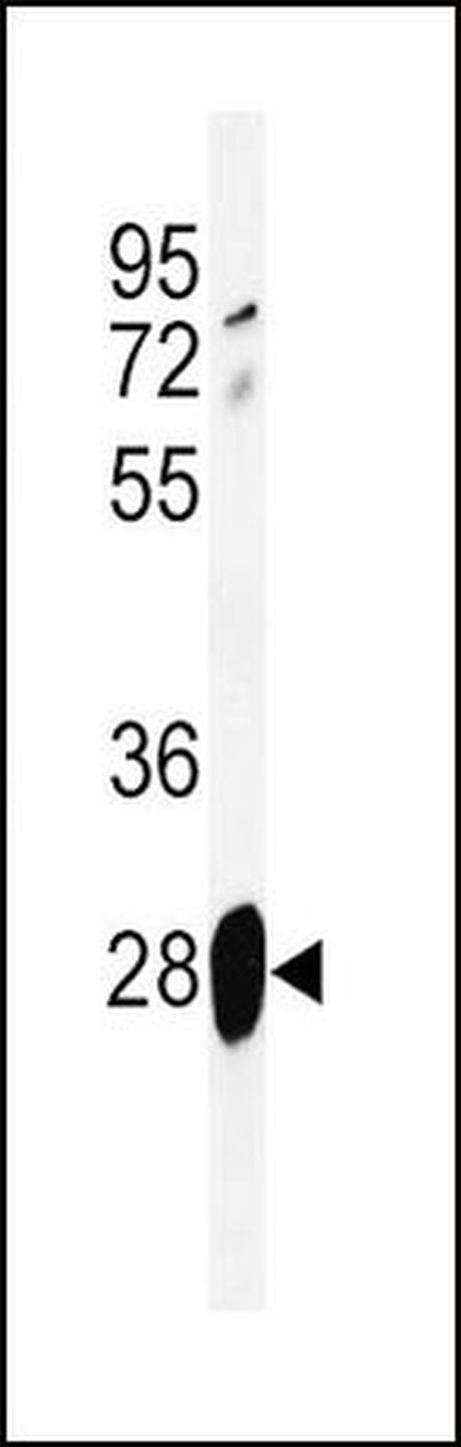 Adrenomedullin Antibody in Western Blot (WB)