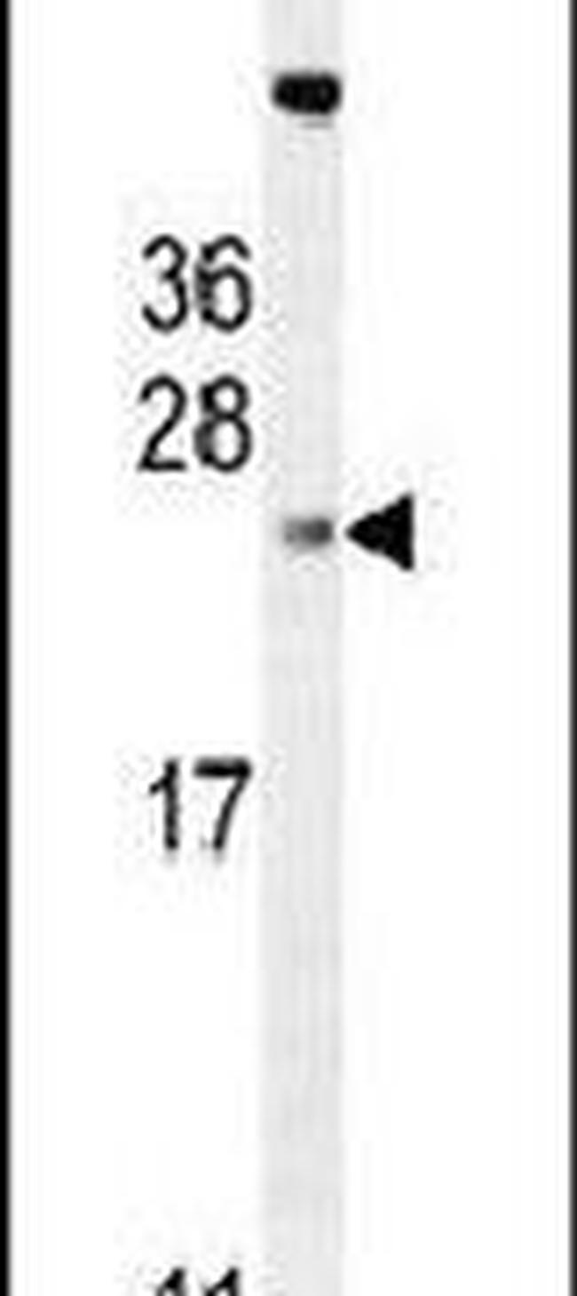 ADO Antibody in Western Blot (WB)