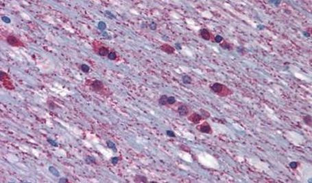 alpha-1a Adrenergic Receptor Antibody in Immunohistochemistry (Paraffin) (IHC (P))