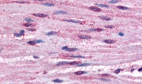 alpha-1b Adrenergic Receptor Antibody in Immunohistochemistry (Paraffin) (IHC (P))