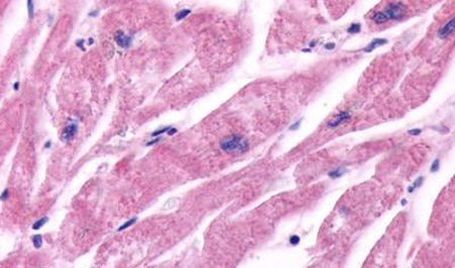 beta-2 Adrenergic Receptor Antibody in Immunohistochemistry (Paraffin) (IHC (P))