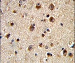 GRK3 Antibody in Immunohistochemistry (IHC)
