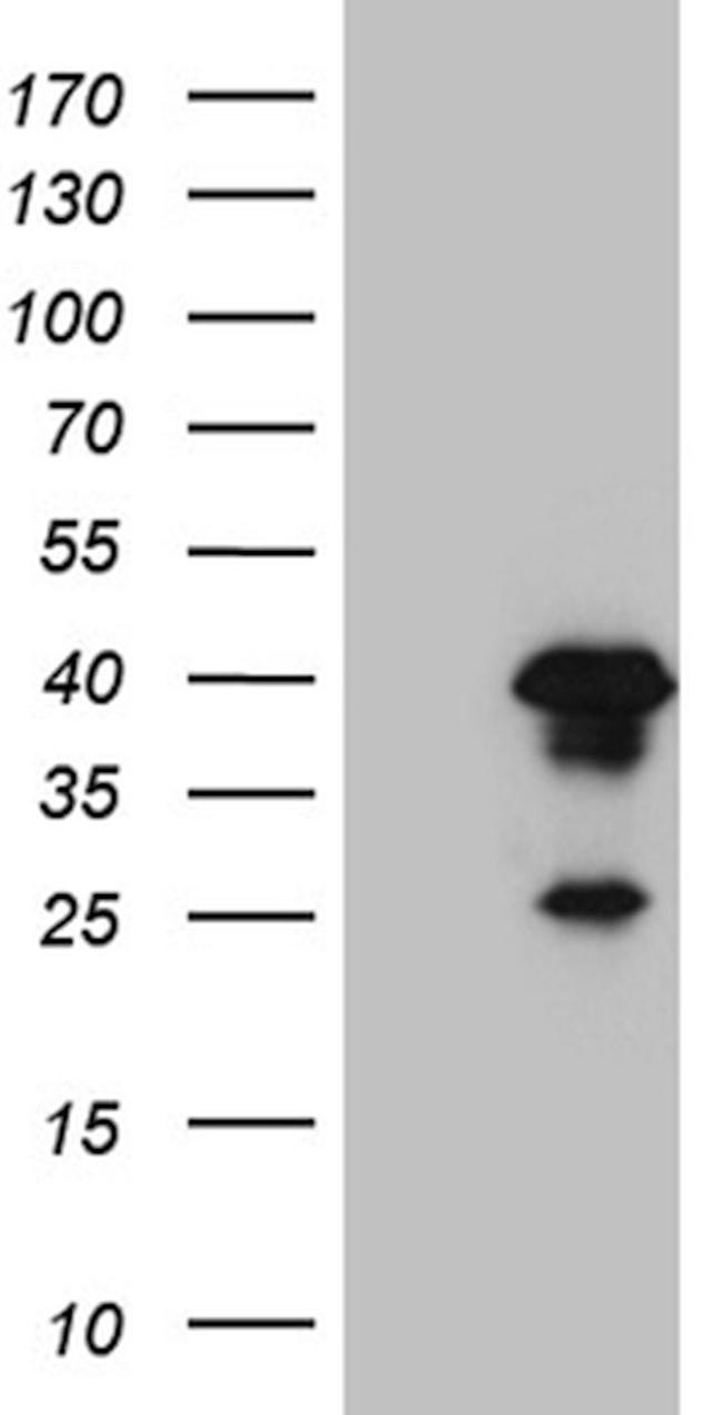 AEBP2 Antibody in Western Blot (WB)