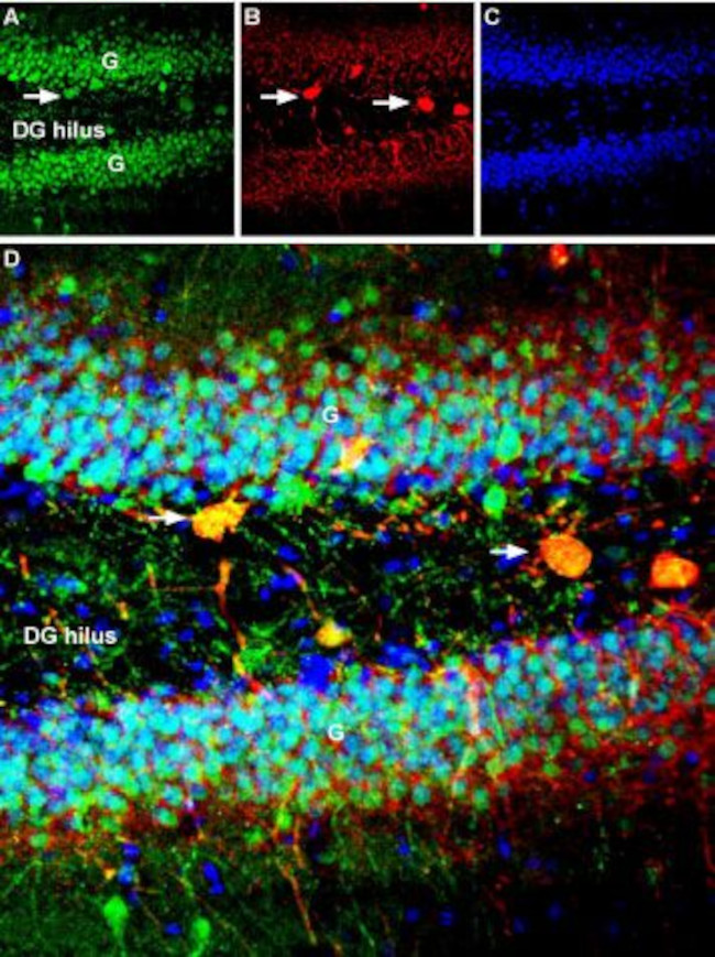 GPER (GPR30) Antibody in Immunohistochemistry (IHC)
