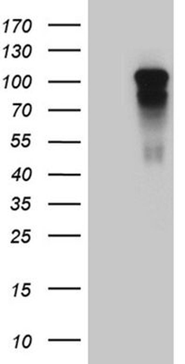 AFAP1 Antibody in Western Blot (WB)