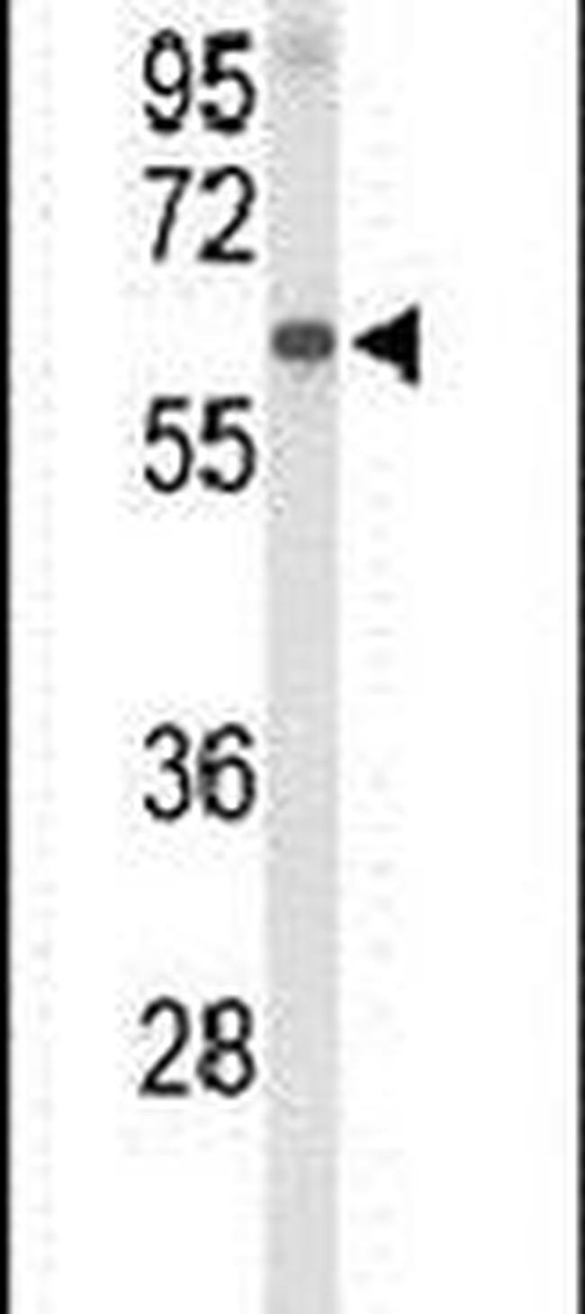 Afamin Antibody in Western Blot (WB)