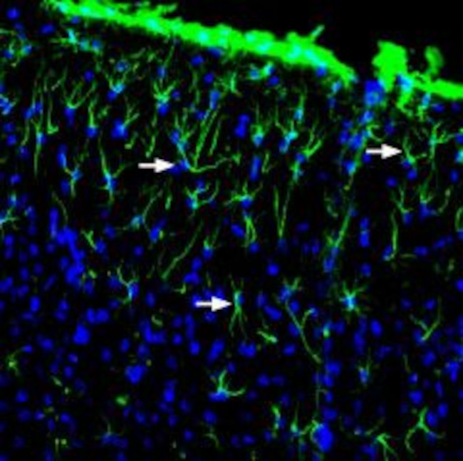 GFAP Antibody in Immunohistochemistry (Frozen) (IHC (F))
