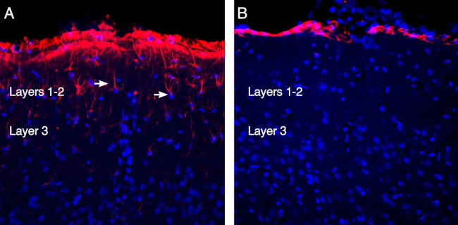 GFAP Antibody in Immunohistochemistry (Frozen) (IHC (F))