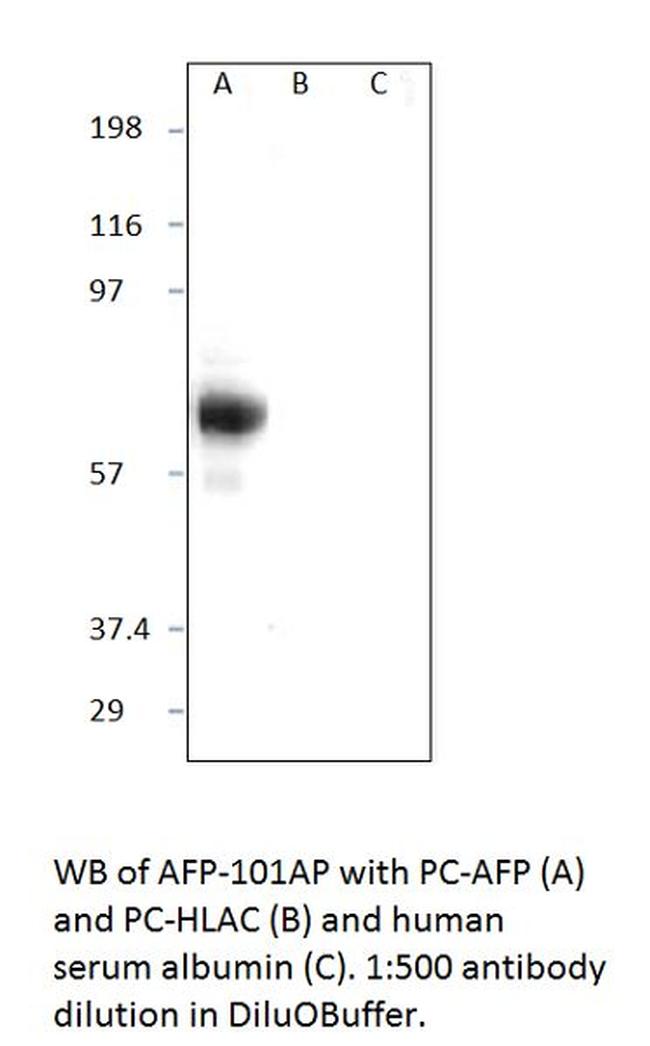 Afp Wb Alpha 1 Fetoprotein Polyclonal Antibody (AFP-101AP)