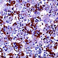 AFP Antibody in Immunohistochemistry (Paraffin) (IHC (P))