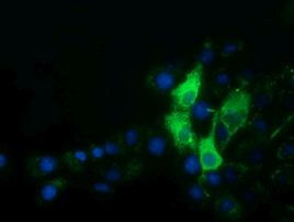 AFP Antibody in Immunocytochemistry (ICC/IF)